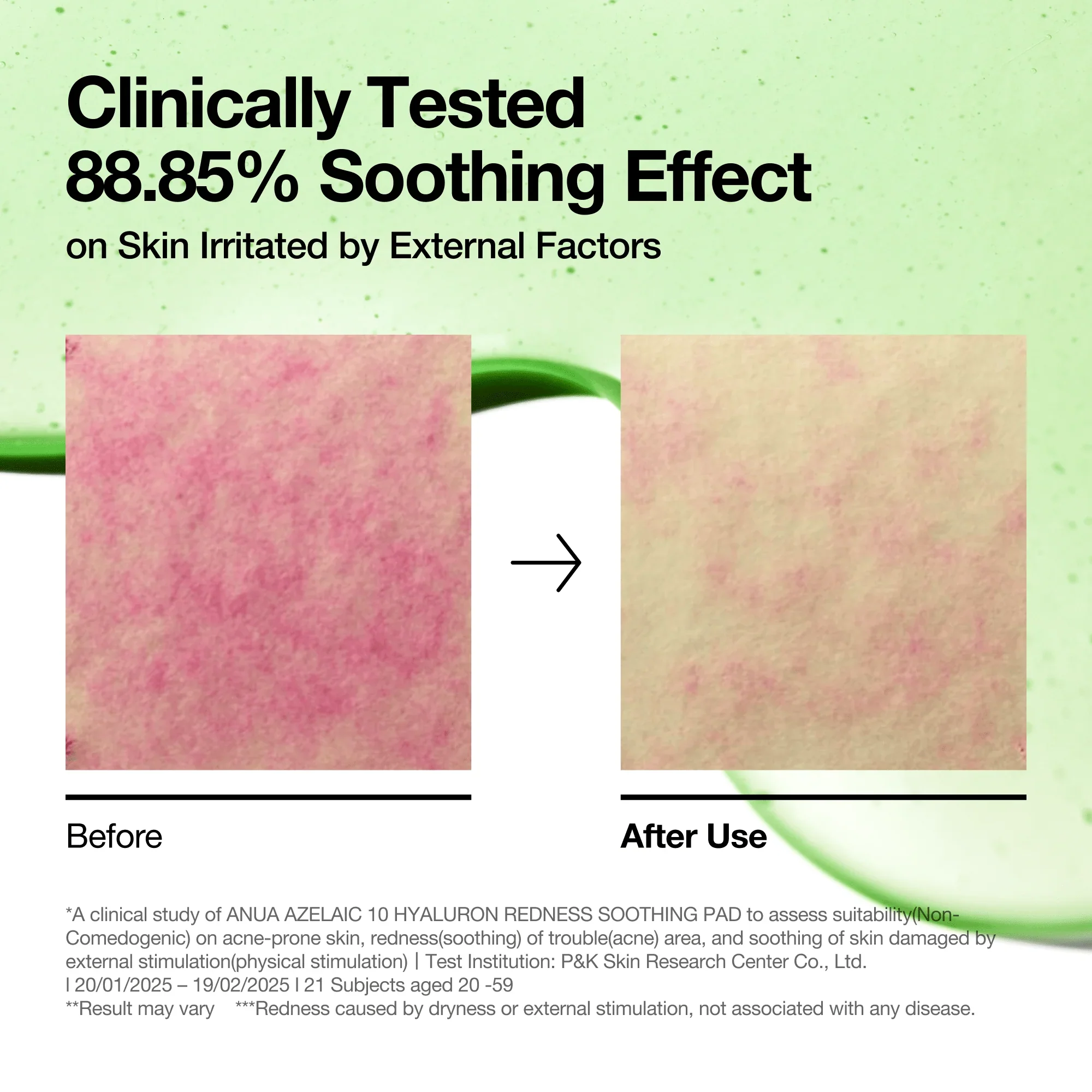 Azelaic 10 Hyaluronic Redness Soothing Pad [90 Pads] - Image 5