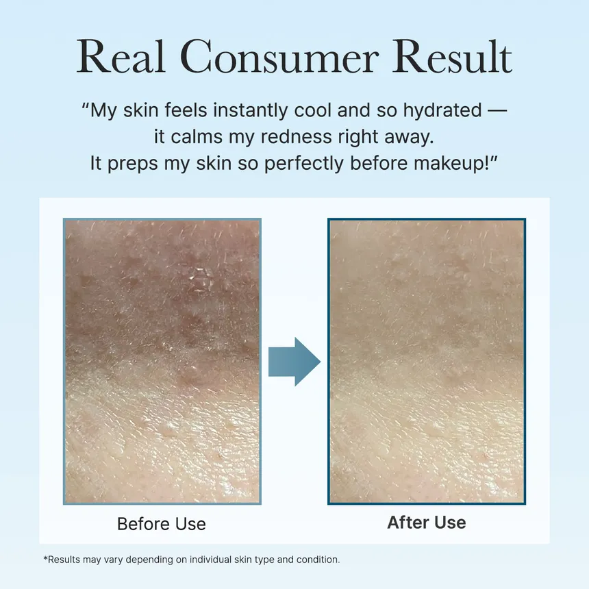 PDRN + Hyaluronic Deep Hydration Pads [90EA] - Image 7