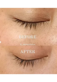 [Benton] Honest Eyelash Serum [10ml] - Image 4