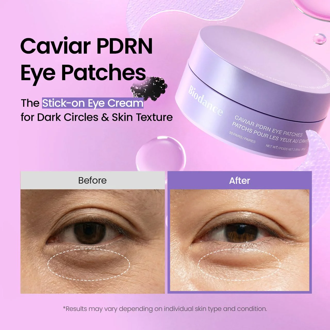 Caviar PDRN Eye Patches [30ea] - Image 3