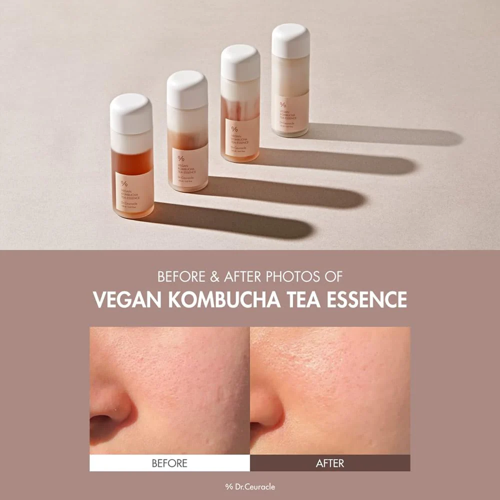Vegan Kombucha Tea Special Set [3 pcs] - Image 4