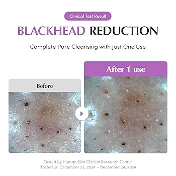 Purple Rice Pore Purifying Pack Cleanser [130g] - Image 7
