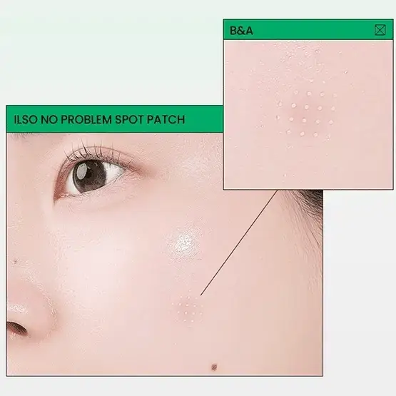 No Problem Spot Patch [1pc / 72 Patches] - Image 3
