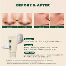 SEOUL 1988 Cleansing Foam: Pine Cica 1% + Probiotics [150ml] - Image 3