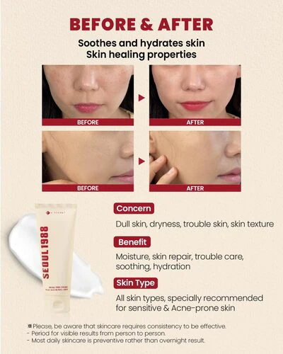 SEOUL 1988 Cream: Snail Mucin 93% + Rice [100ml] - Image 5