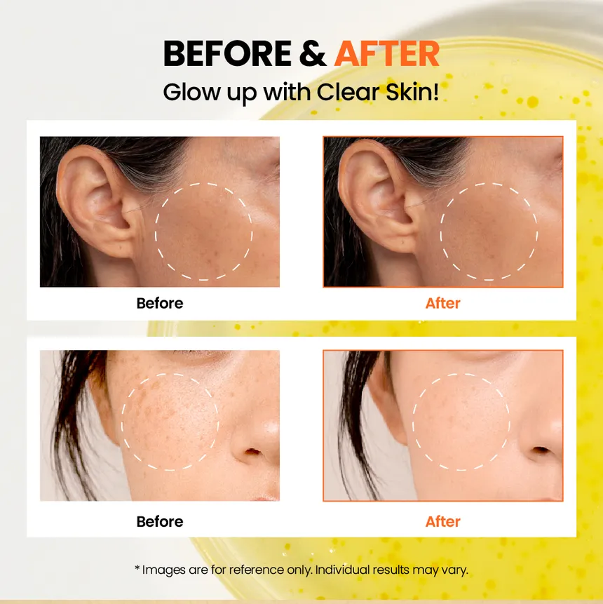 SEOUL 1988 Glow Serum: Niacinamide 15% + Yuja [30ml] - Image 6