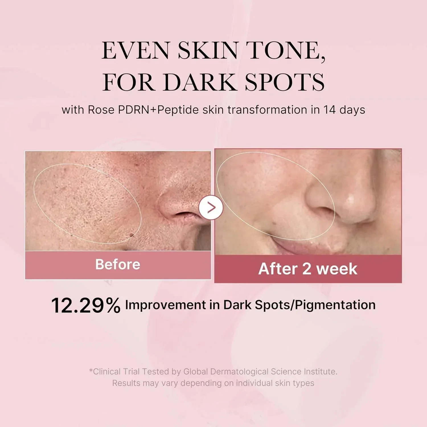 PDRN Pink Niacinamide Milky Toner [150ml] - Image 7