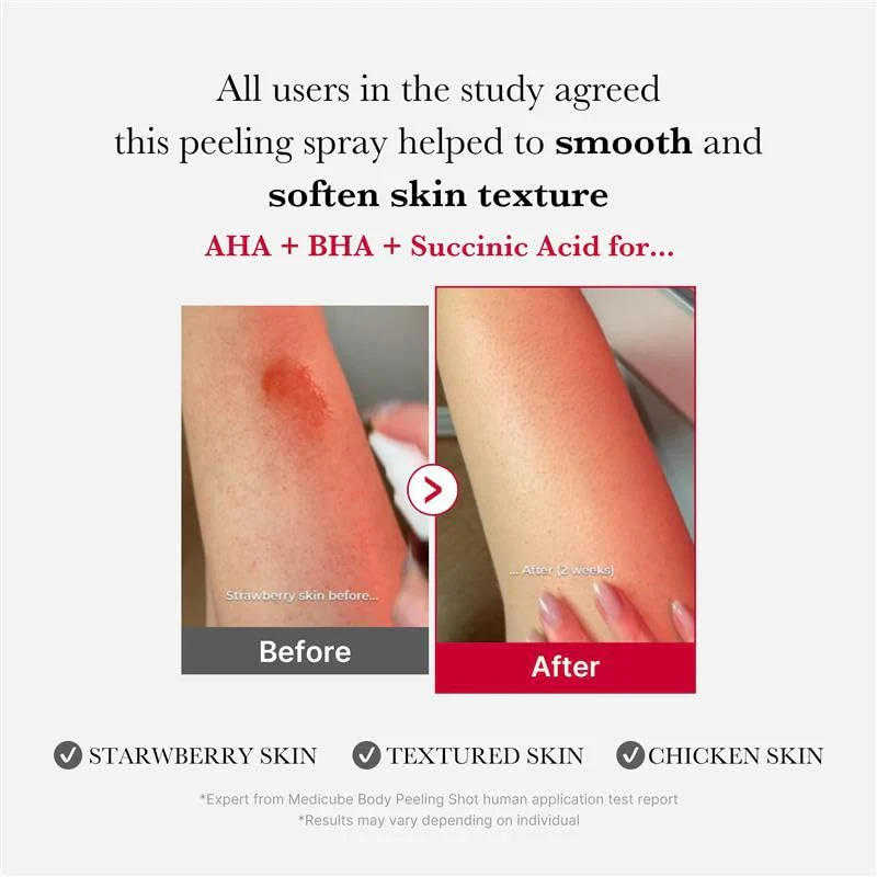 Red Acne Body Peeling Shot [110g] - Image 5