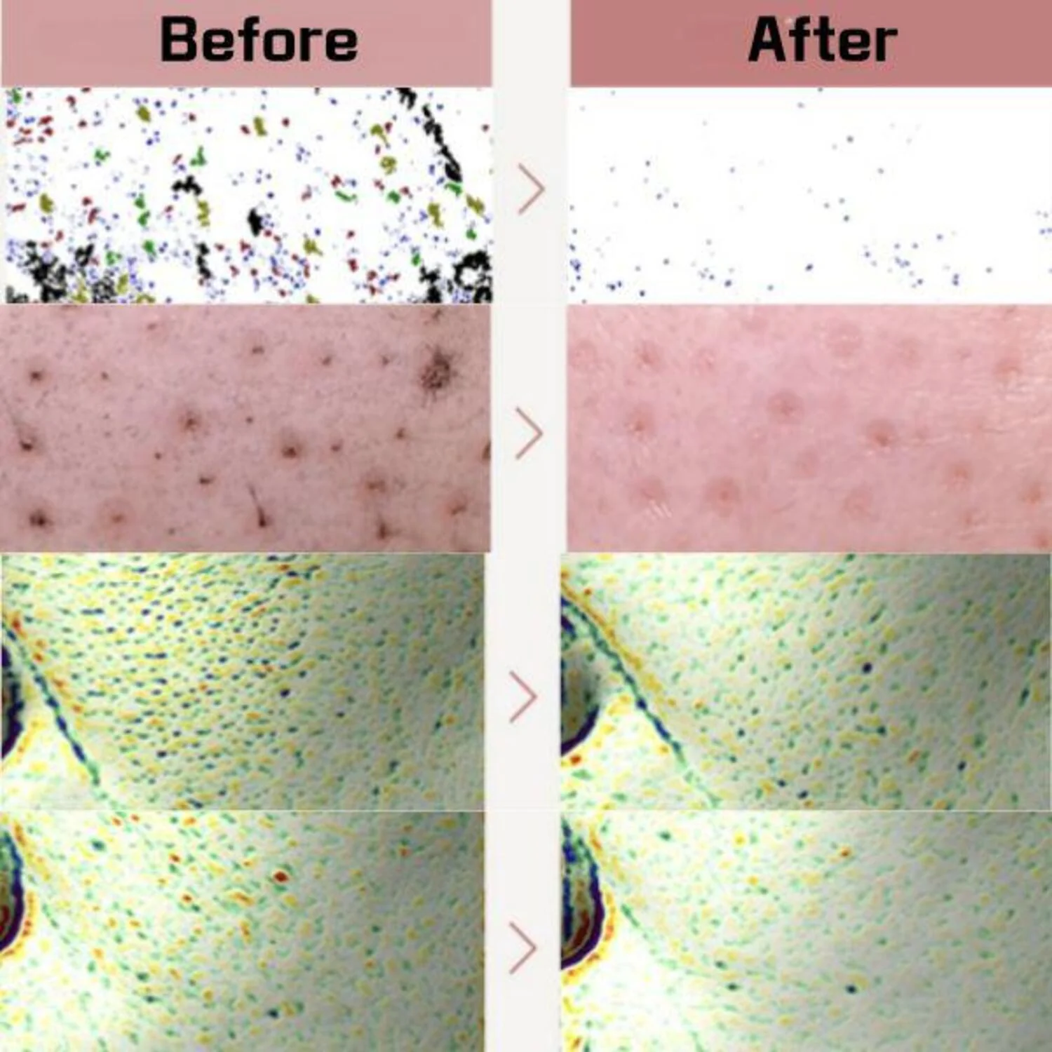 Red Bean Retinol Pore Peel To Foam [120ml] - Image 5