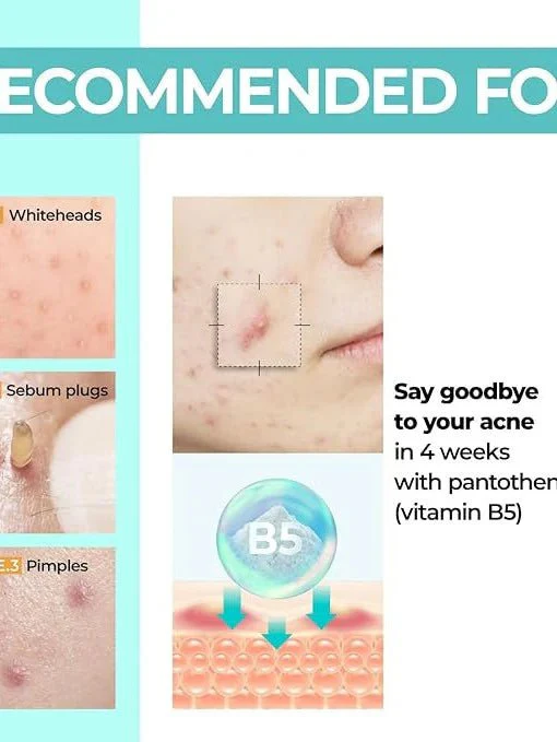 No.1 Pantothenic B5 Active Soothing Cream [80ml]  - Image 3