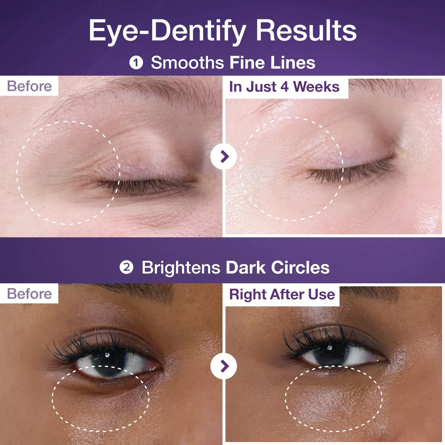 No.9 NAD+ Retinol Volumetox Eye Cream [10ml] - Image 4