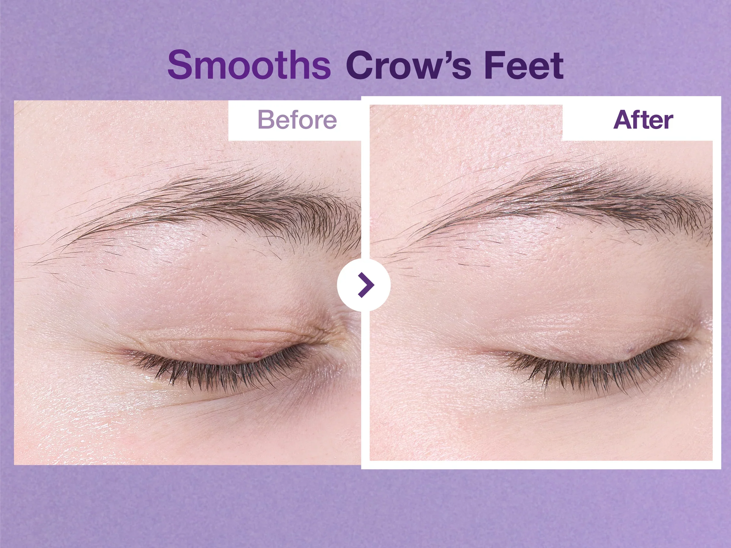 No.9 NAD+ Retinol Volumetox Eye Cream [10ml] - Image 6