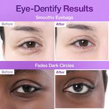 No.9 NAD Under Eye Patches [5pc] - Image 5