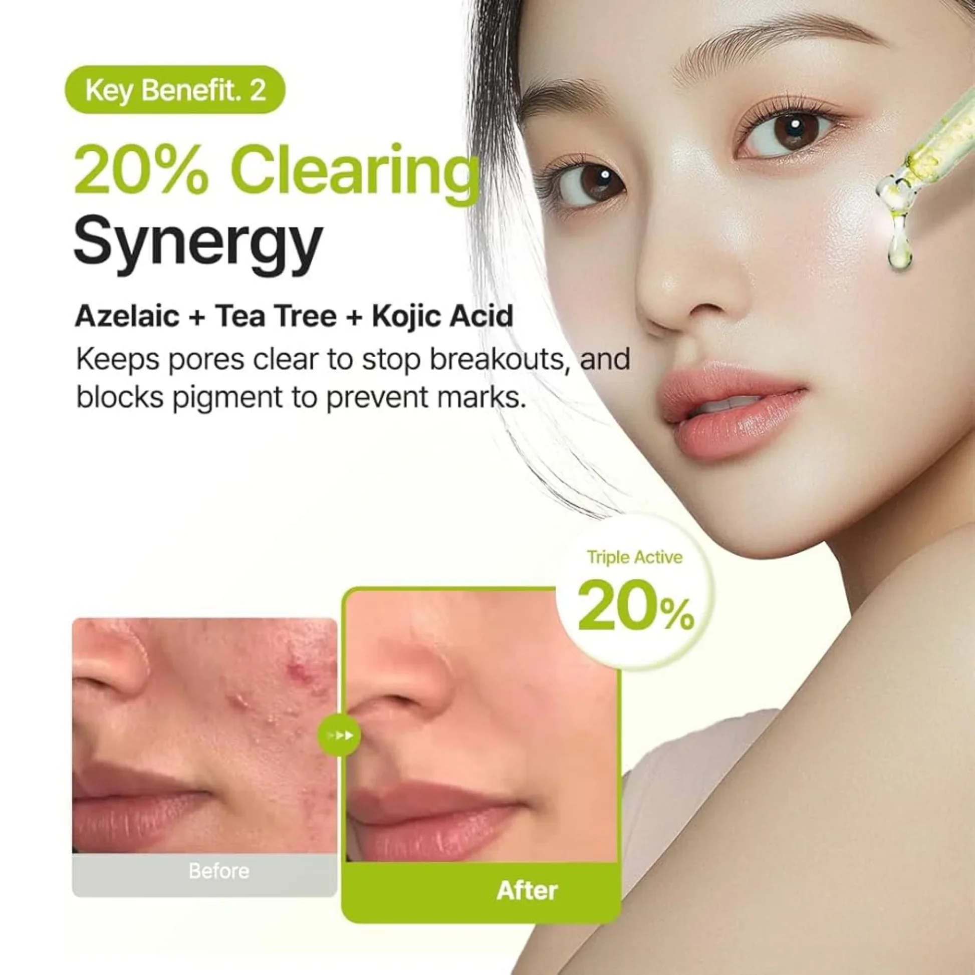 Azelaic Acid 10 Kojic Tea Tree Serum [30ml] - Image 4