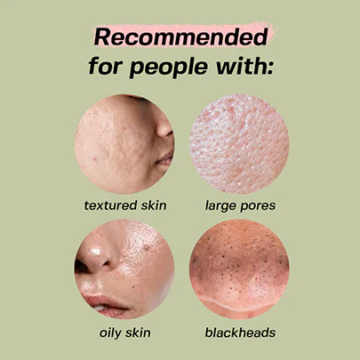 Green Tomato Pore Peeling Jumbo Pad [60 Pads] - Image 5