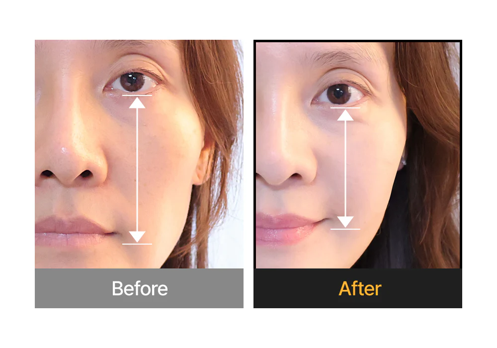 Silk Peptide Intensive Lifting Cream [50ml] - Image 4